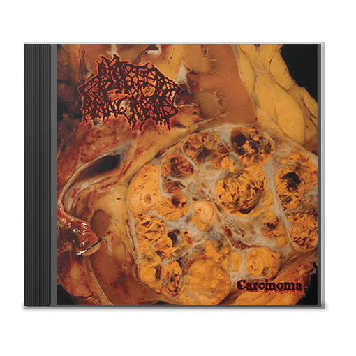 Blasted Pancreas "Carcinoma" CD