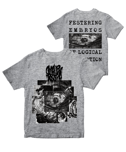 SMALLPOX AROMA “Festering Embryos of Logical Corruption” GREY T-SHIRT